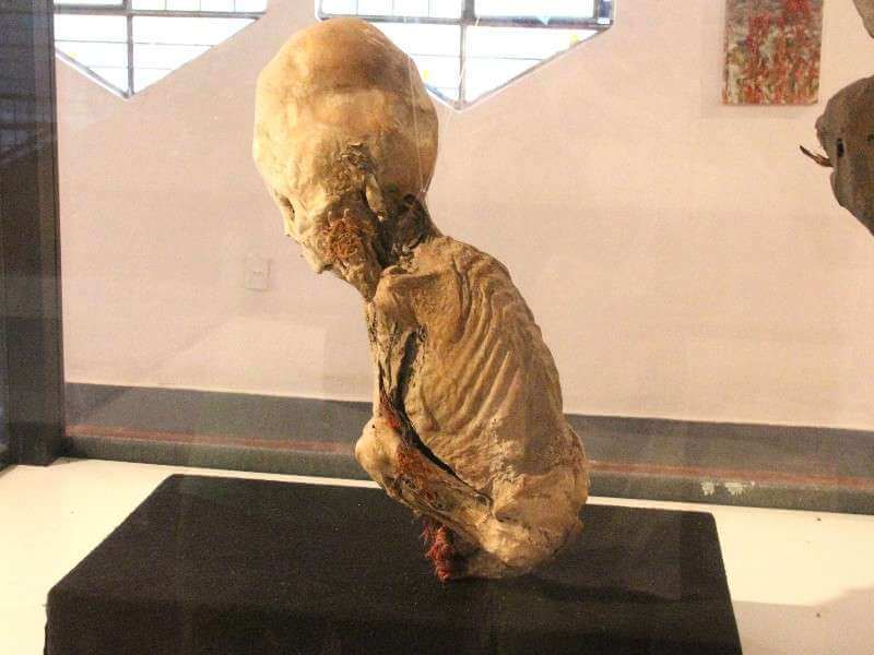 Huatara Child Elongated Skull