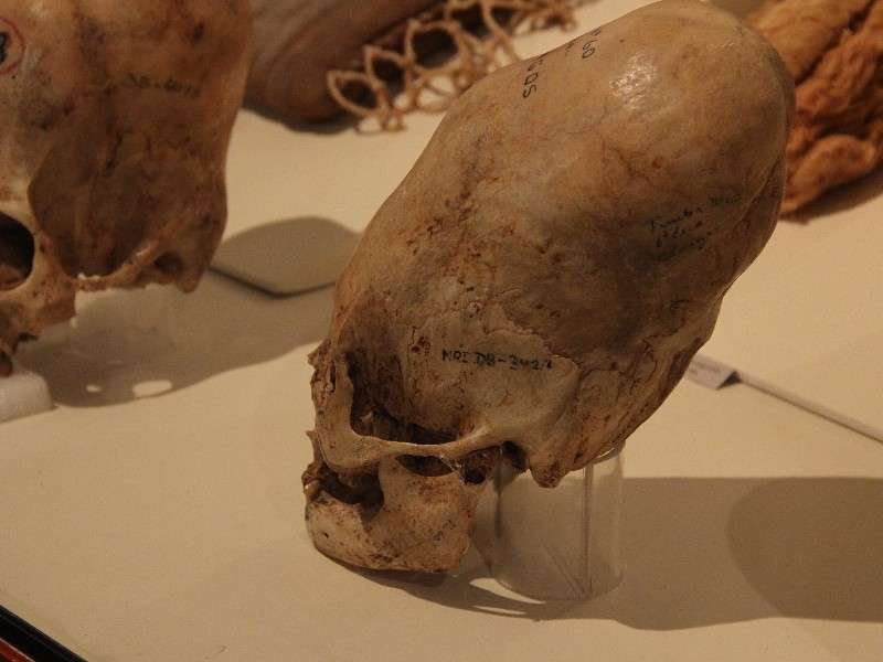 Ica Museum Chognos Skull
